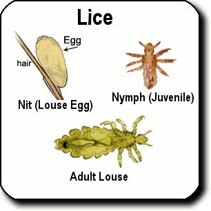 Headhunters Lice Removal Service Has Lice In Atlanta On The Run