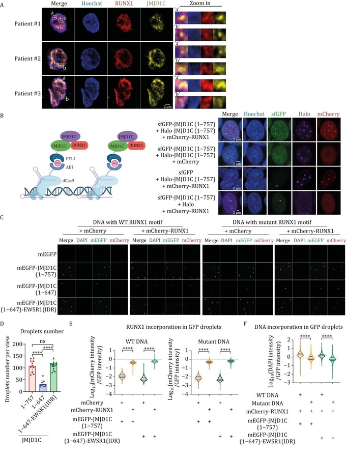 Unlocking a new path to AML treatment: targeting the JMJD1C-RUNX1 axis for leukemia progression control