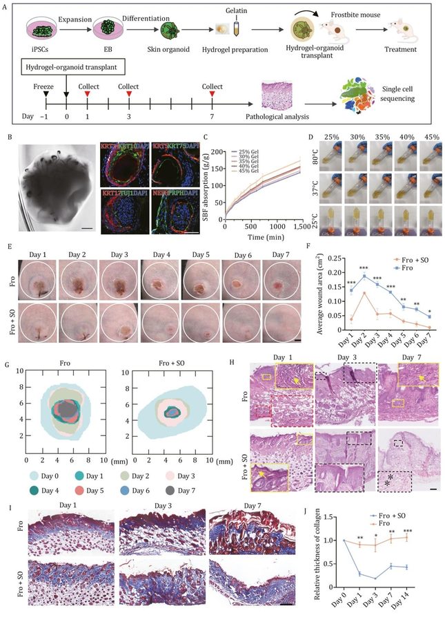 Healing frostbite without scars: the promise of skin organoids